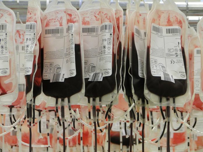 Investigadores encontraron la manera de crear “sangre universal” - Itagüí Hoy